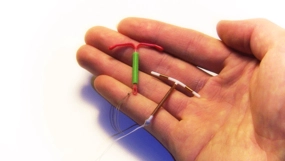 Spiral Takıldıktan Sonra Adet