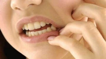 Adet Kanaması Kokusu Adet Kanaması Kokusu