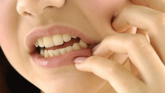 Adet Kanaması Kokusu Adet Kanaması Kokusu