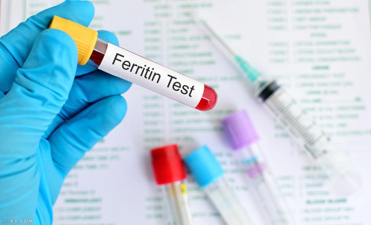 Ferritin Düşüklüğü Adet Geciktirir mı?